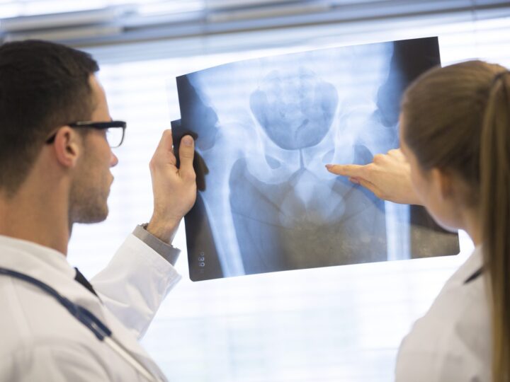 Hip Pain