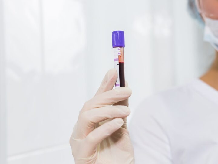 PRP and Regenerative Medicine: What It Helps, and What to Be Careful About